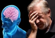 Dementia and Alzheimer's Disease